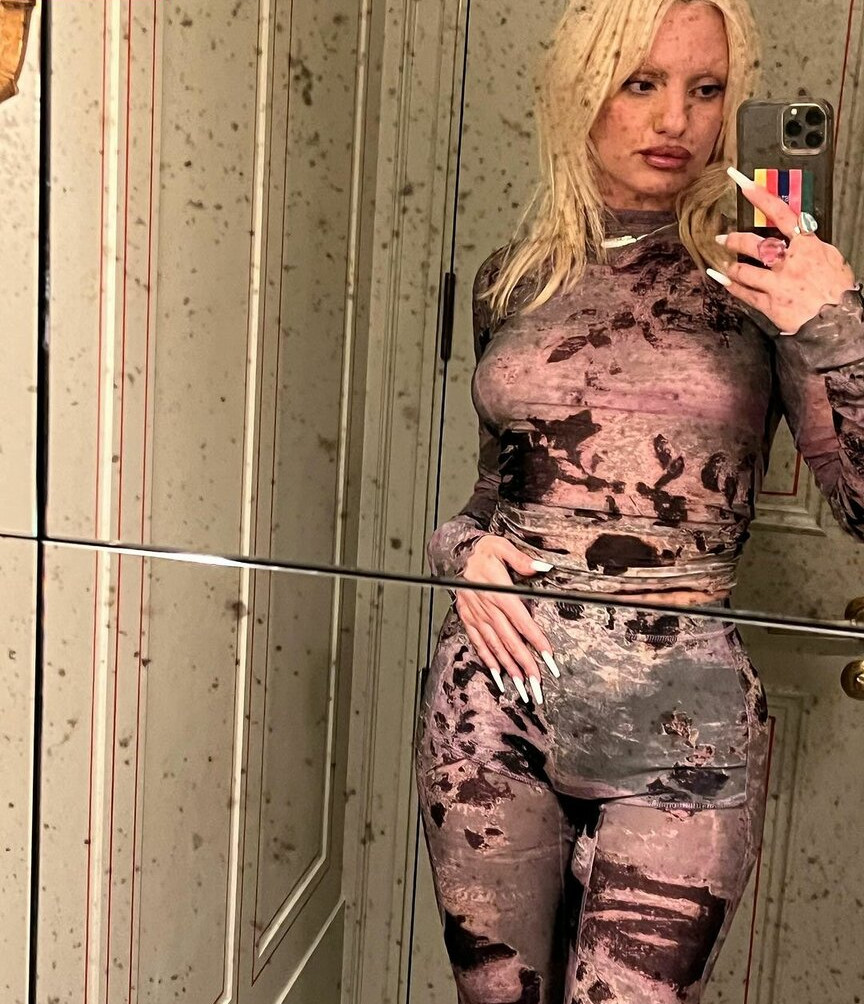 alexandra-stan gallery photo #787