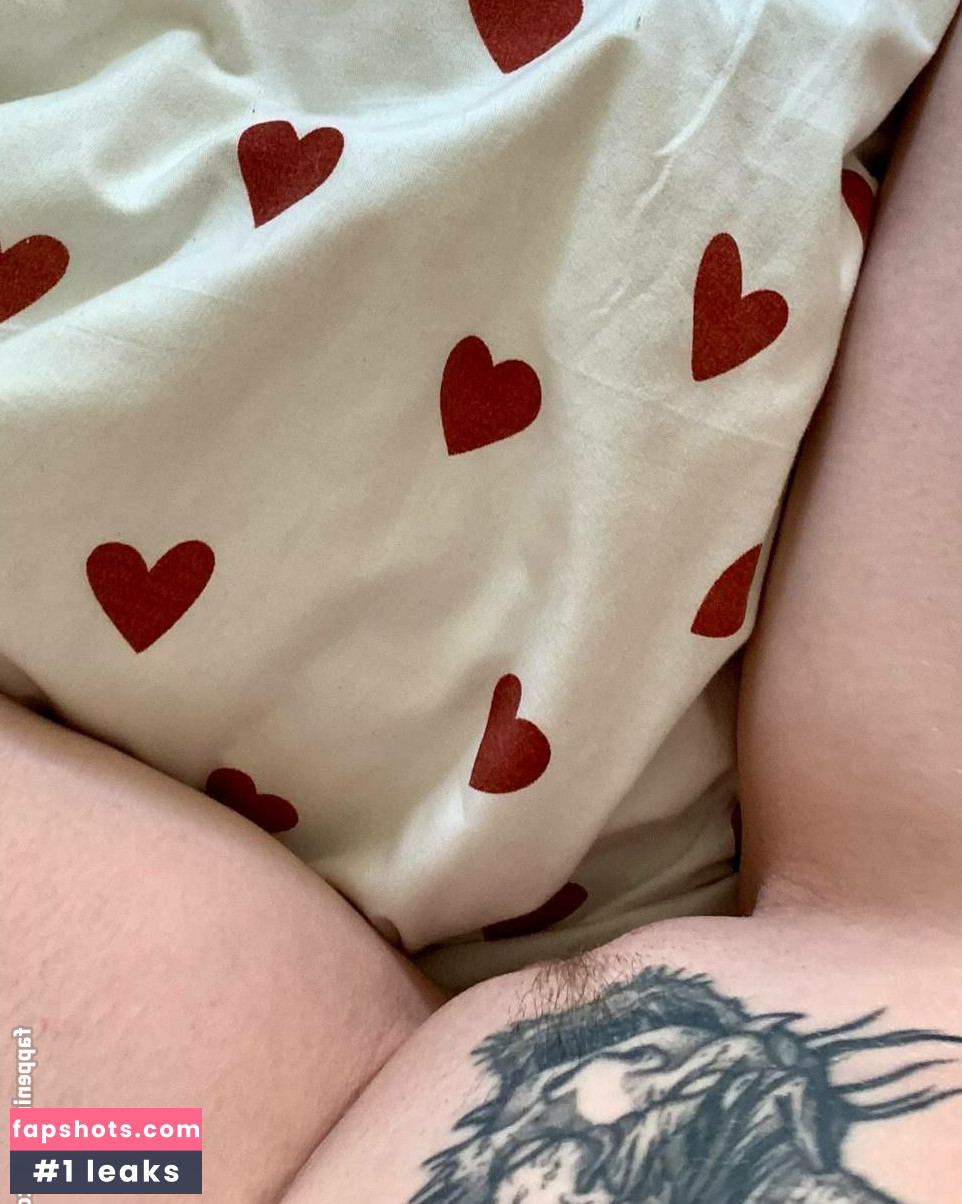 Aorta gallery photo #30