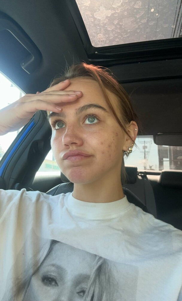 emma-brooks gallery photo #911