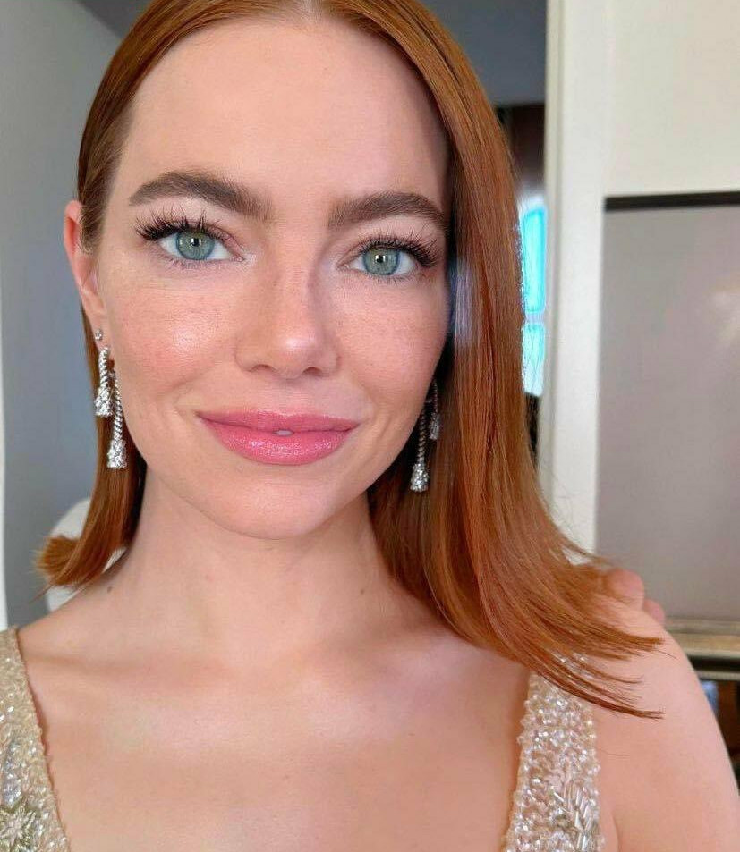 emma-stone gallery photo #1303