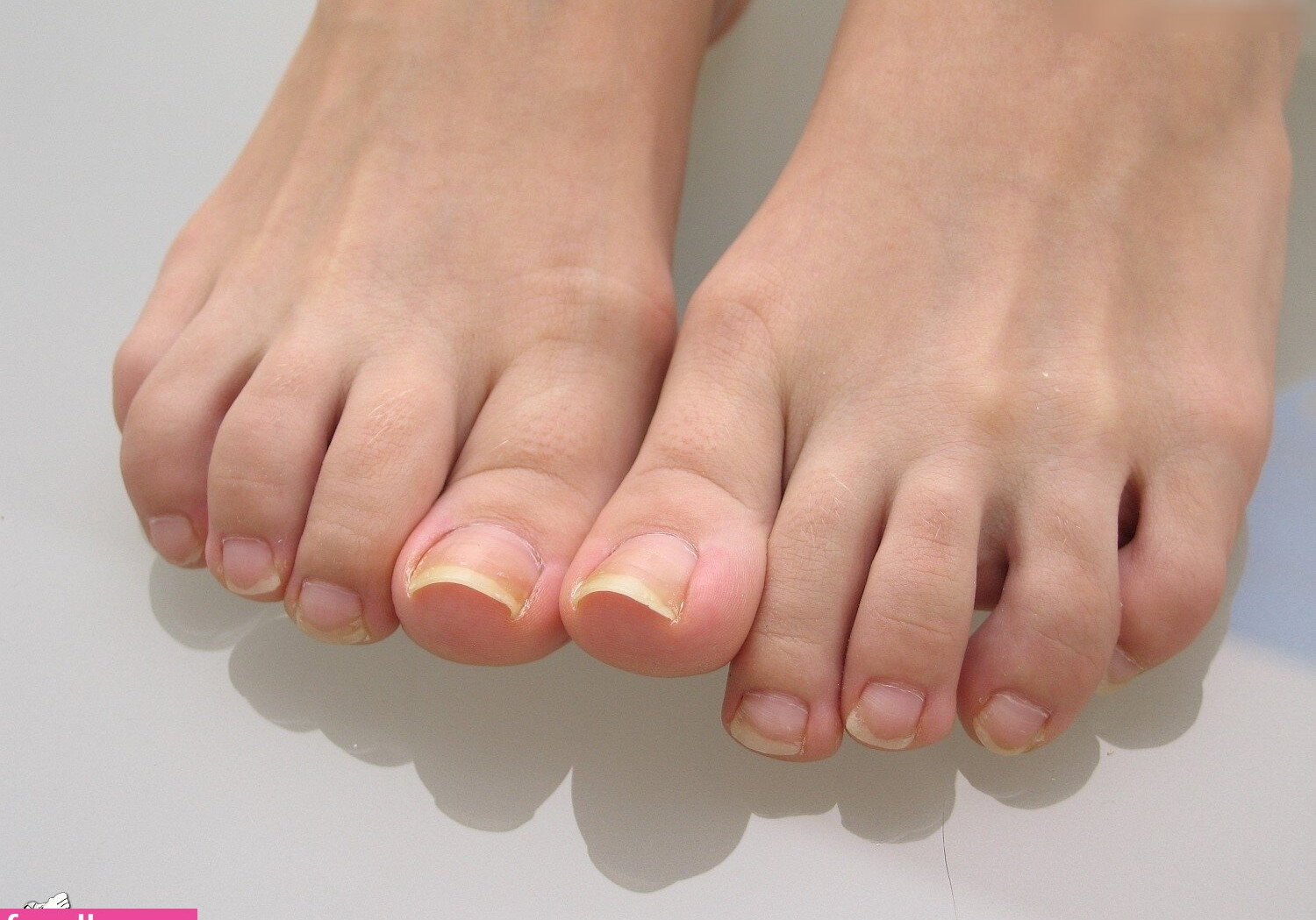 footlovegirls Nahé úniky fotek pouze od fanoušků #1755 - Fapshots