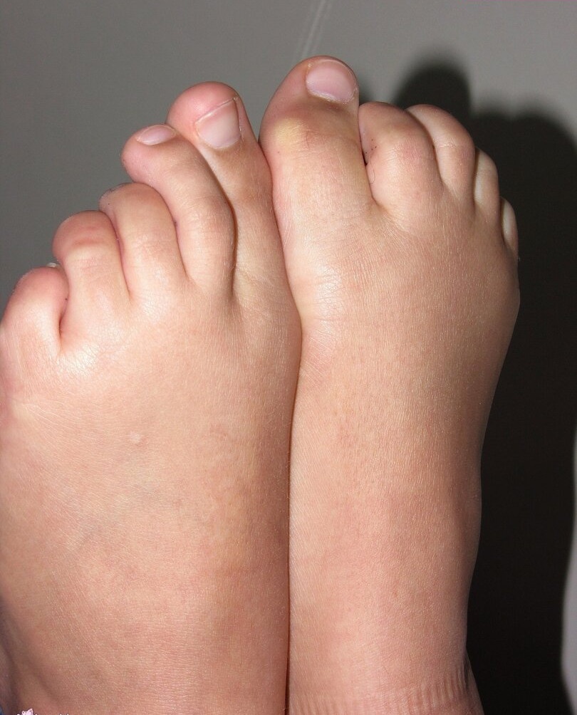 footlovegirls Nahé úniky fotek pouze od fanoušků #845 - Fapshots