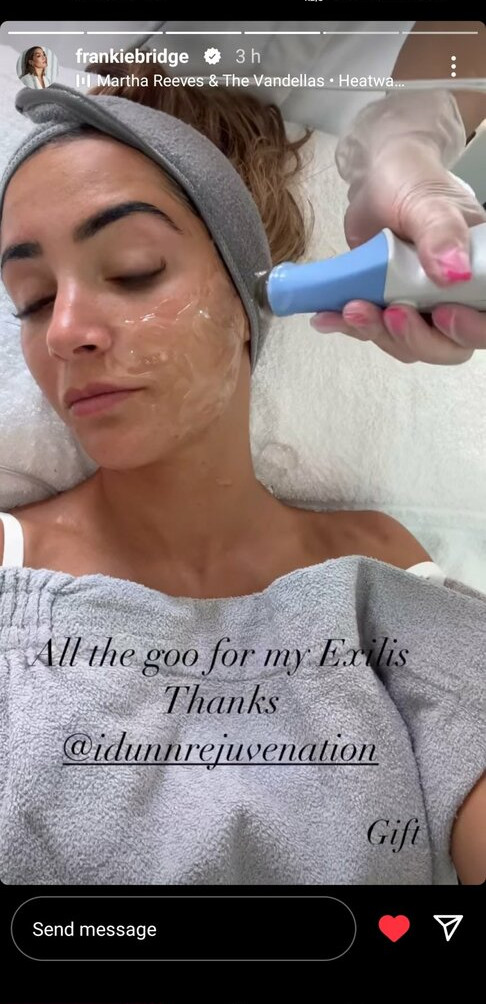 frankie-bridge gallery photo #1412