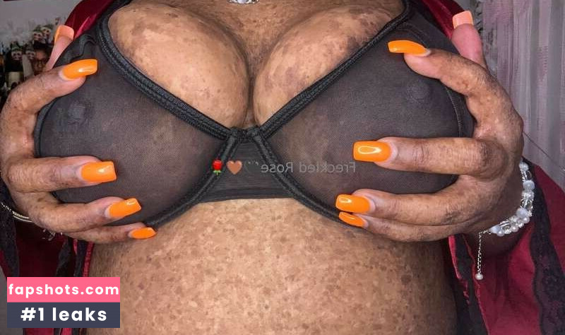 freckledfantasy5 gallery photo #3