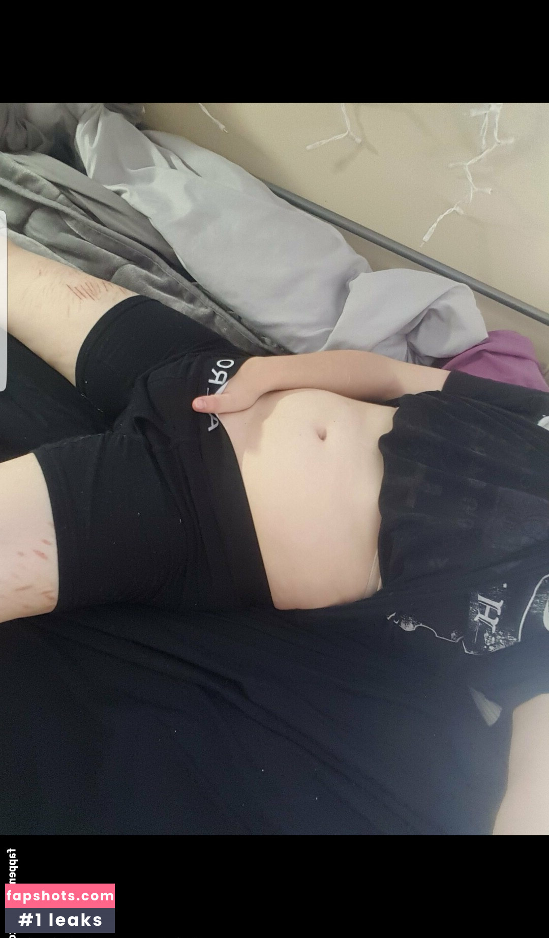 ftmtwinky gallery photo #2