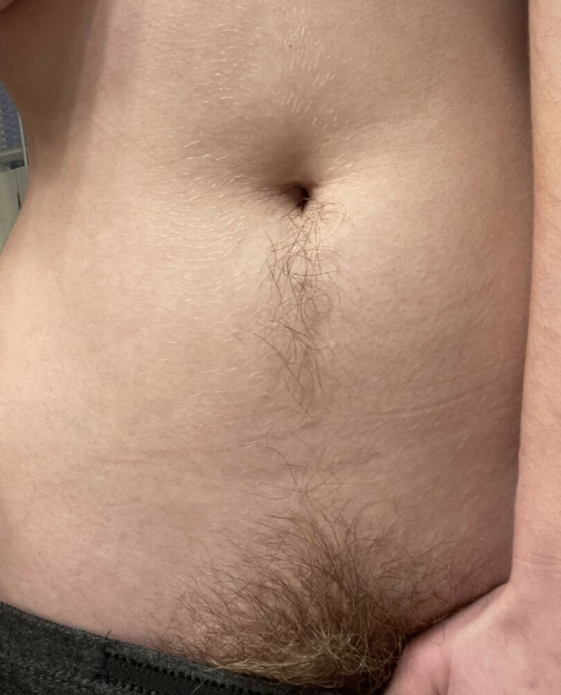 hairy-women gallery photo #935