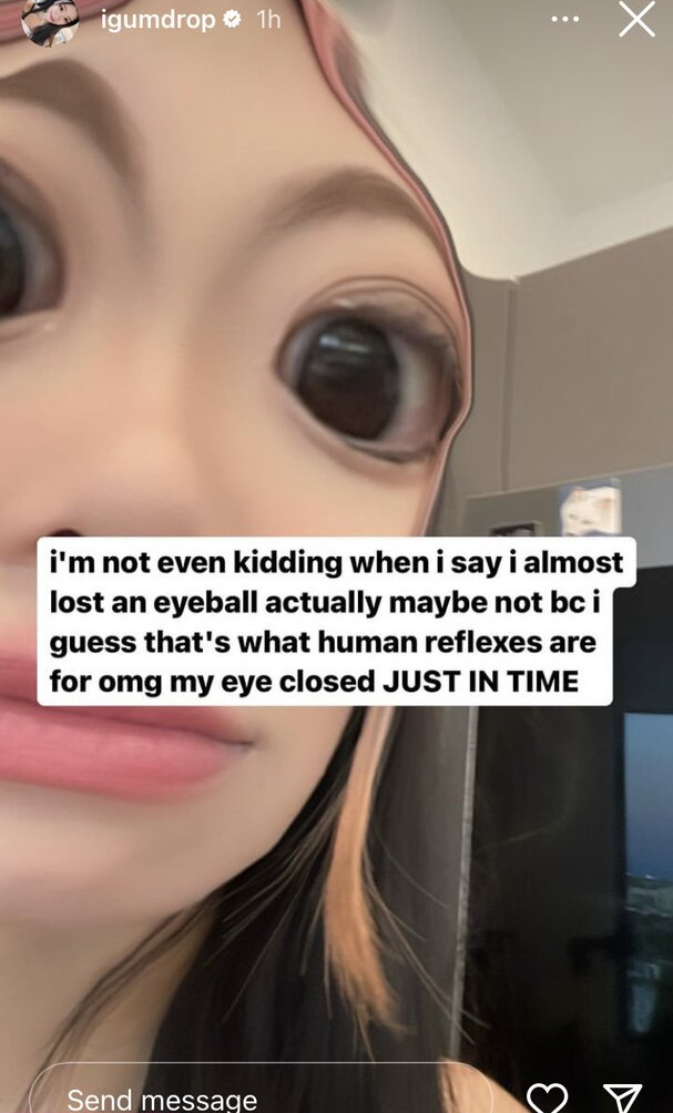 igumdrop gallery photo #527