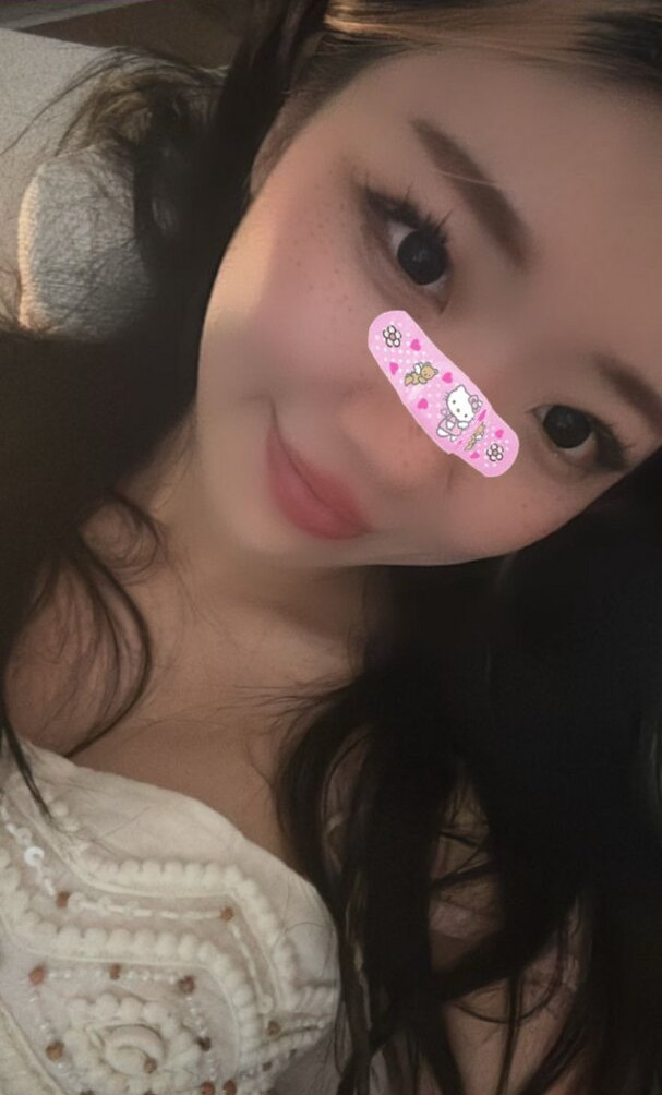 igumdrop gallery photo #549