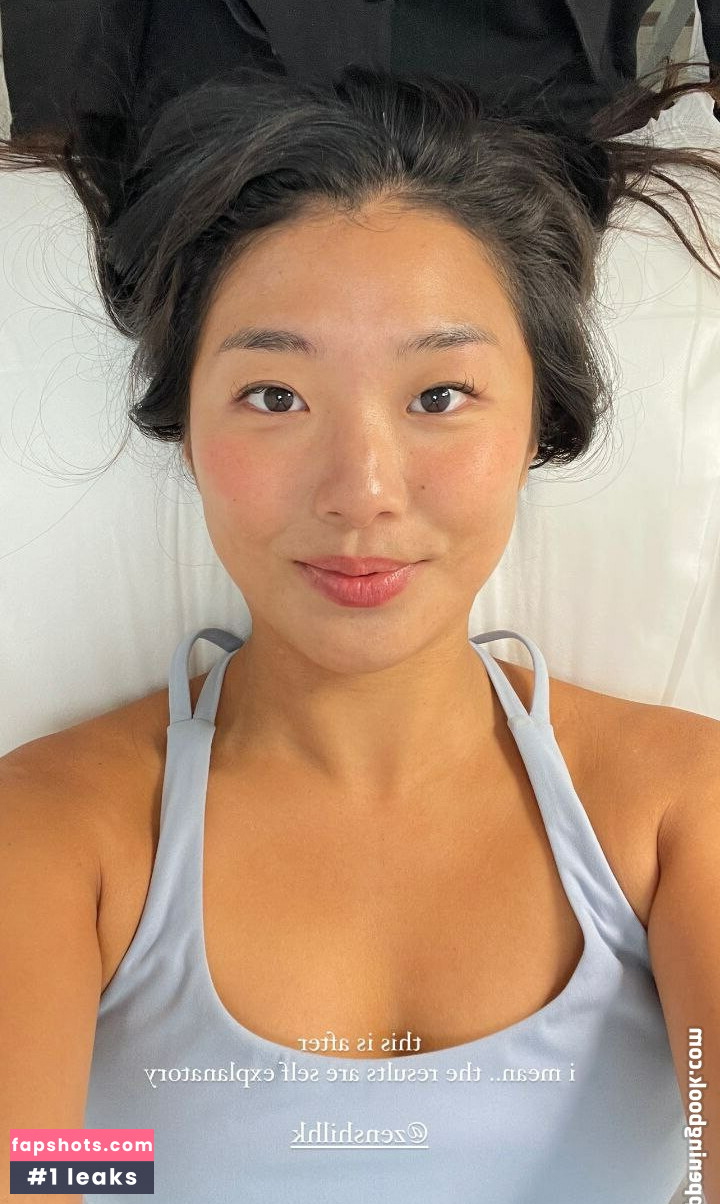 Laparasian gallery photo #9