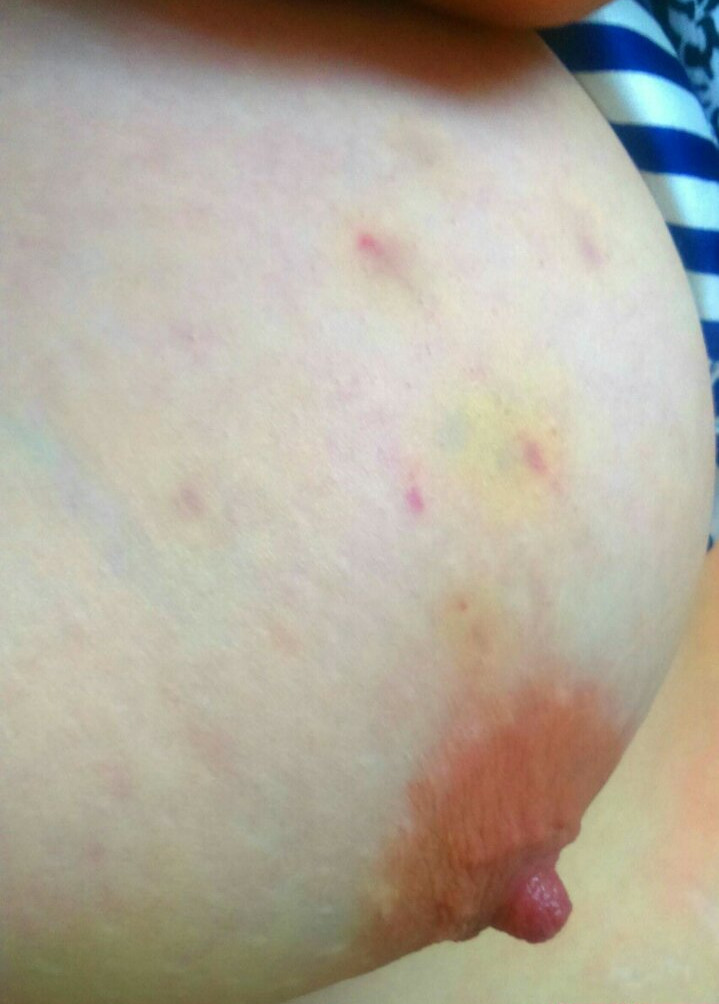 models-on-purpleport Nacktheit OnlyFans Fotos #1377 - Fapshots