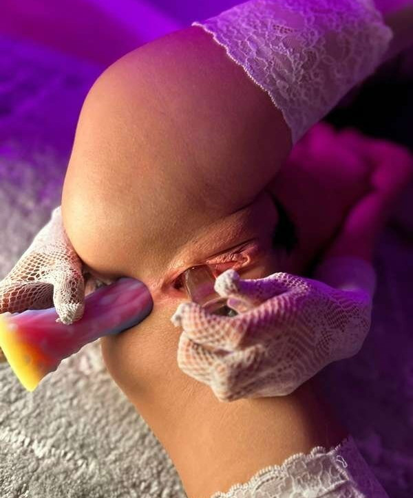 skinny-ver1-0 Nahé úniky fotek pouze od fanoušků #1310 - Fapshots