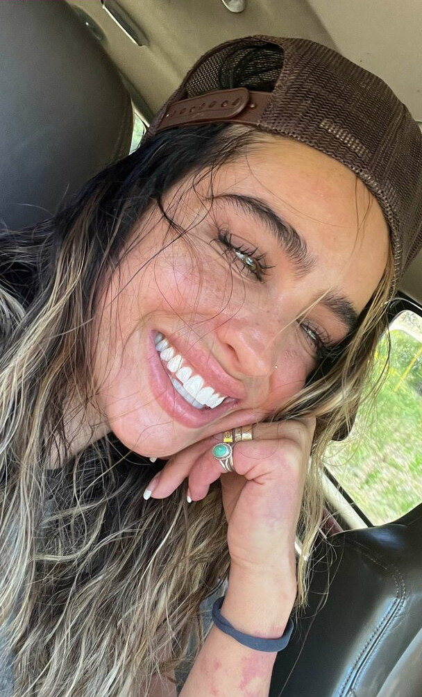 sommer-ray gallery photo #1880