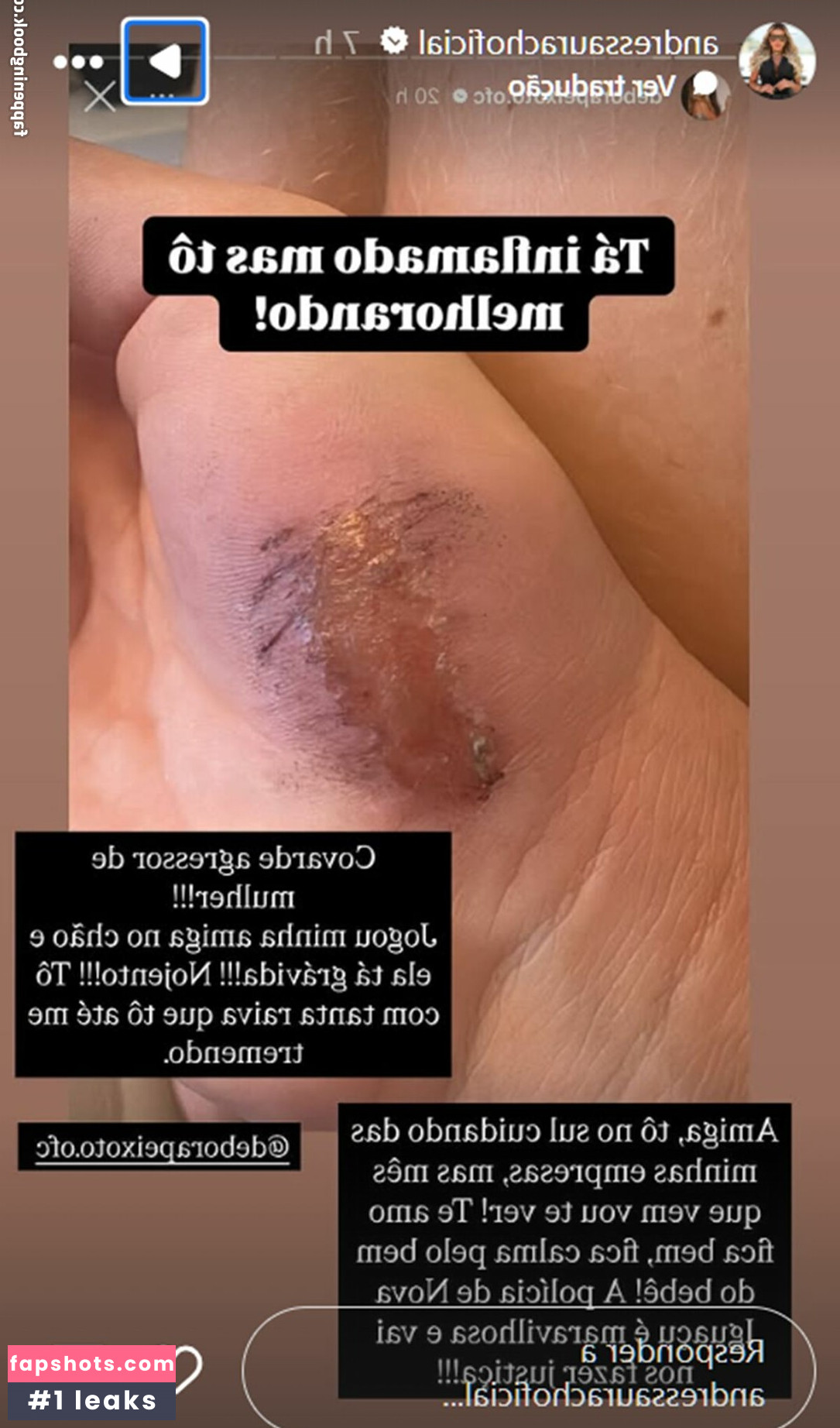 Tretas gallery photo #3