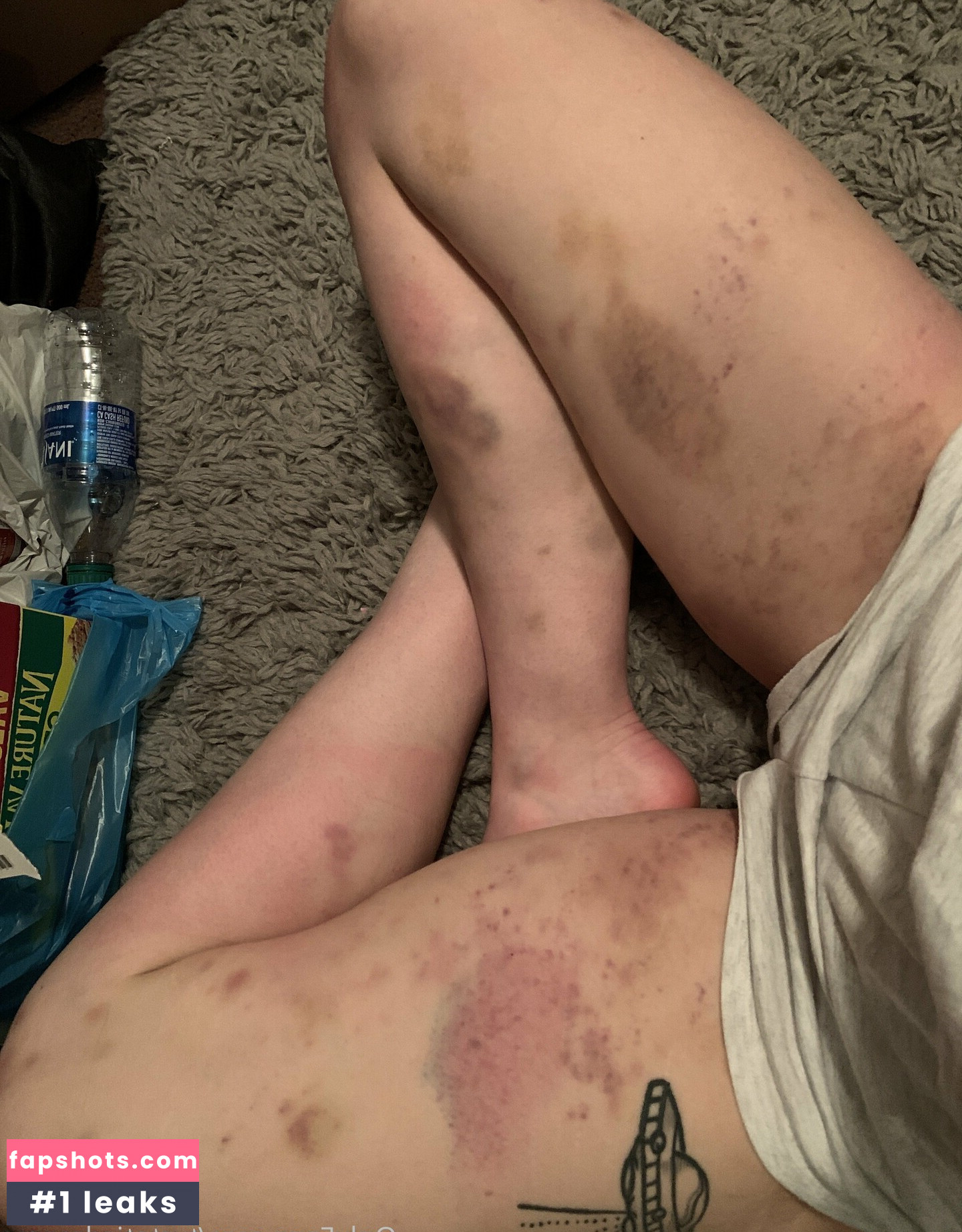 tvstaticdreams gallery photo #2