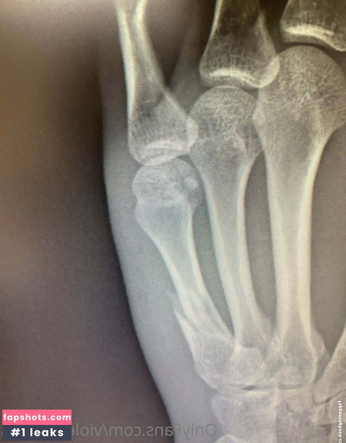 violetcosmos Nahé úniky fotek pouze od fanoušků #42 - Fapshots