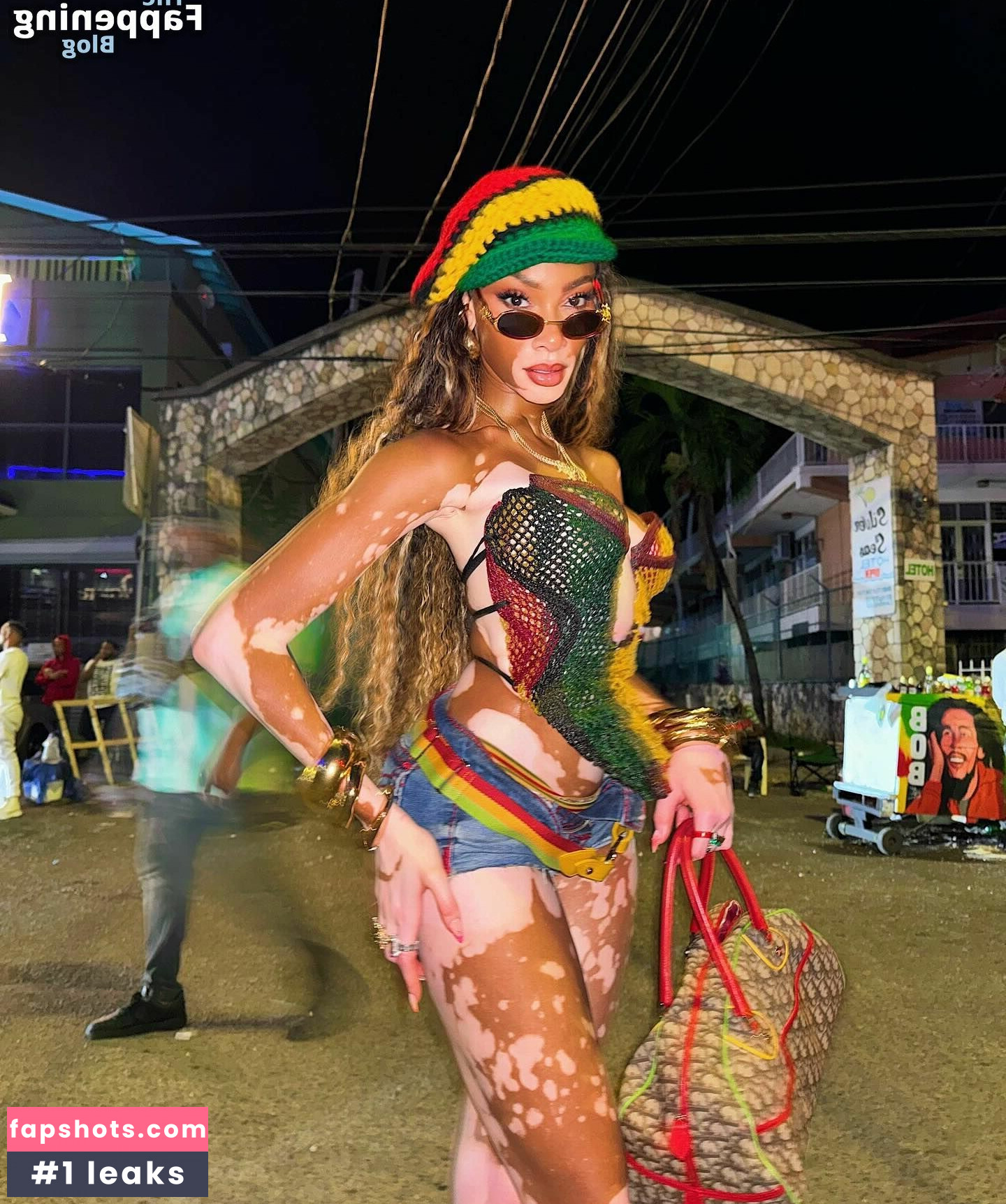 Winnie Harlow Nude Leaks OnlyFans Photos #125 - LeakJerk