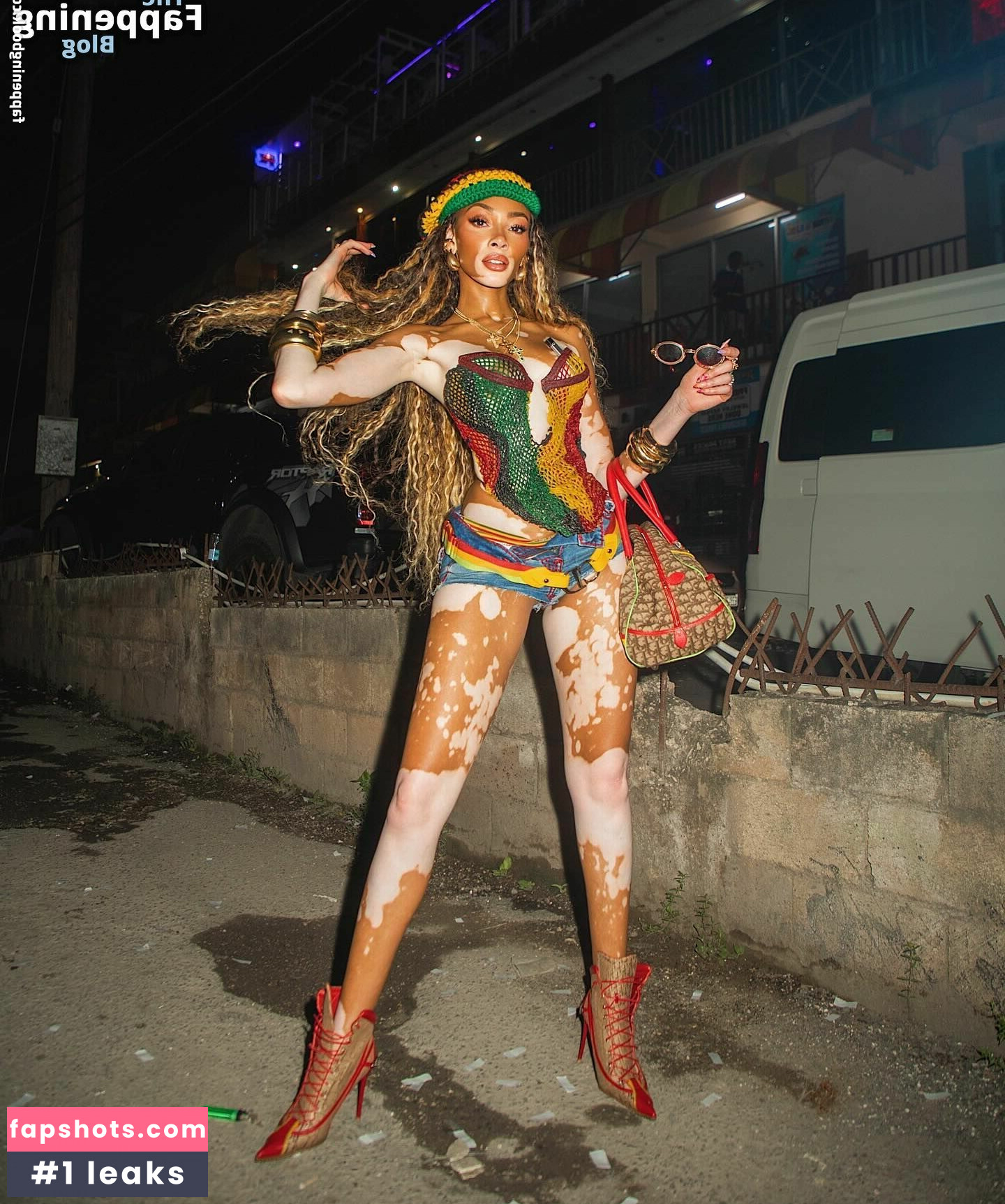 Winnie Harlow Nude Leaks OnlyFans Photos #126 - LeakJerk