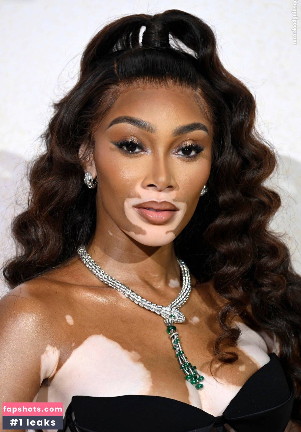 Winnie Harlow Nacktheit OnlyFans Fotos #15 - Fapshots