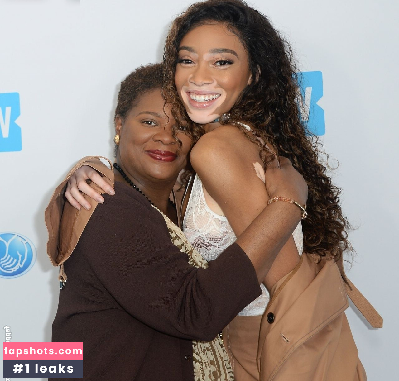 Winnie Harlow Nacktheit OnlyFans Fotos #18 - Fapshots