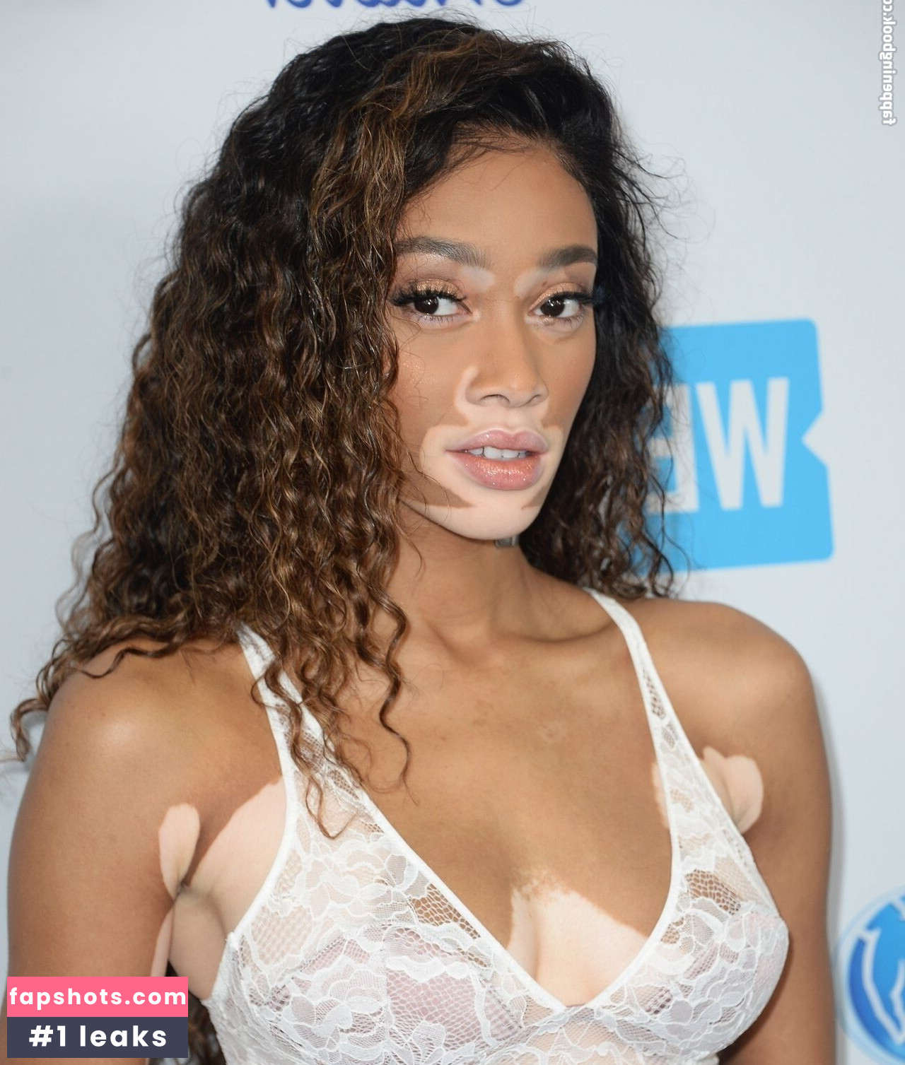 Winnie Harlow Nacktheit OnlyFans Fotos #19 - Fapshots