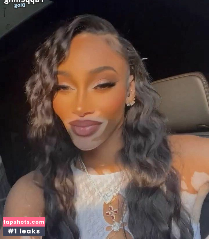 Winnie Harlow Nude Leaks OnlyFans Photos #227 - LeakJerk