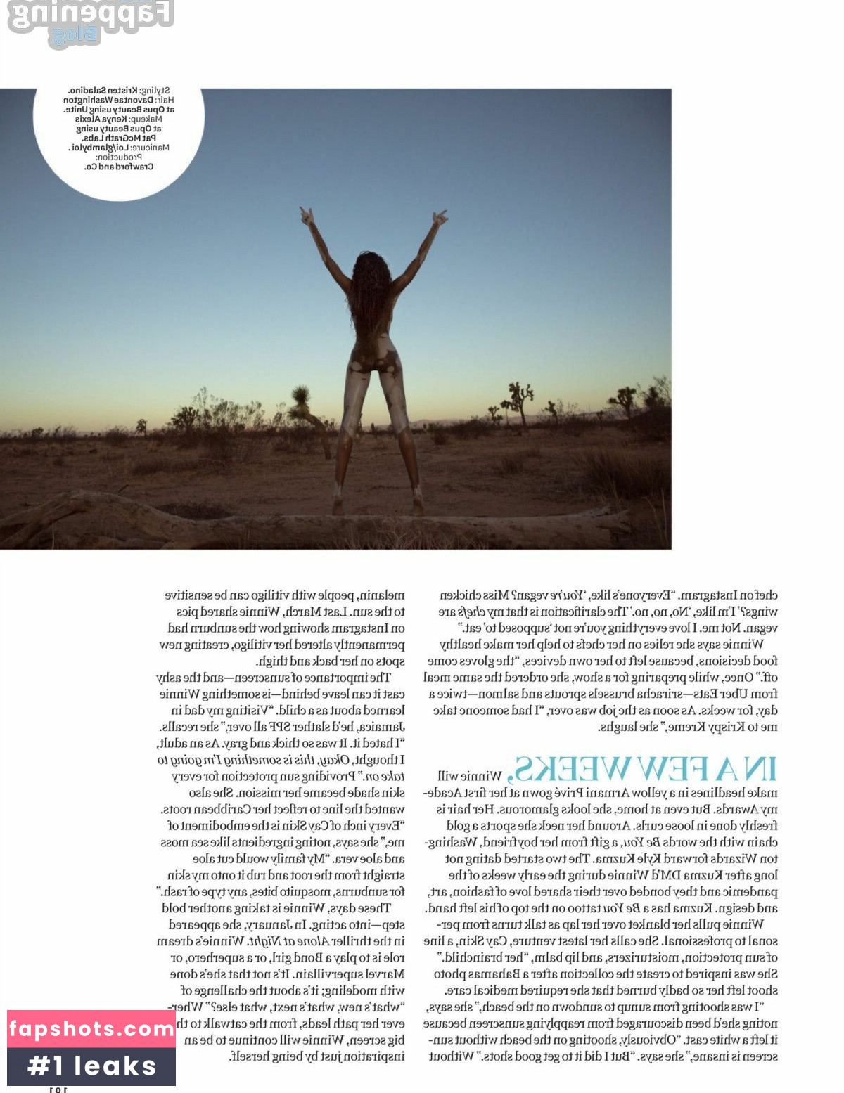 Winnie Harlow Nude Leaks OnlyFans Photos #233 - LeakJerk