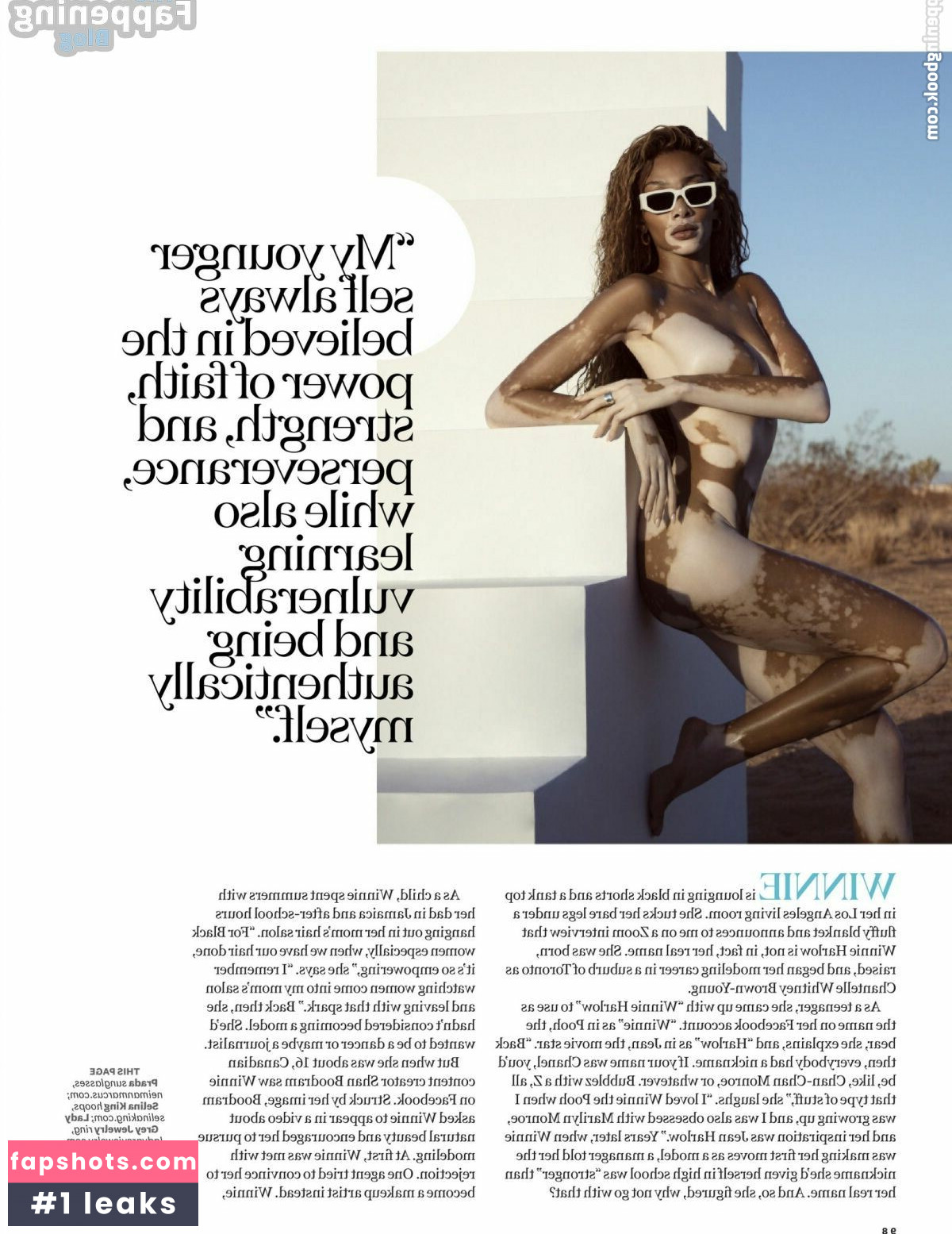 Winnie Harlow Nude Leaks OnlyFans Photos #235 - LeakJerk