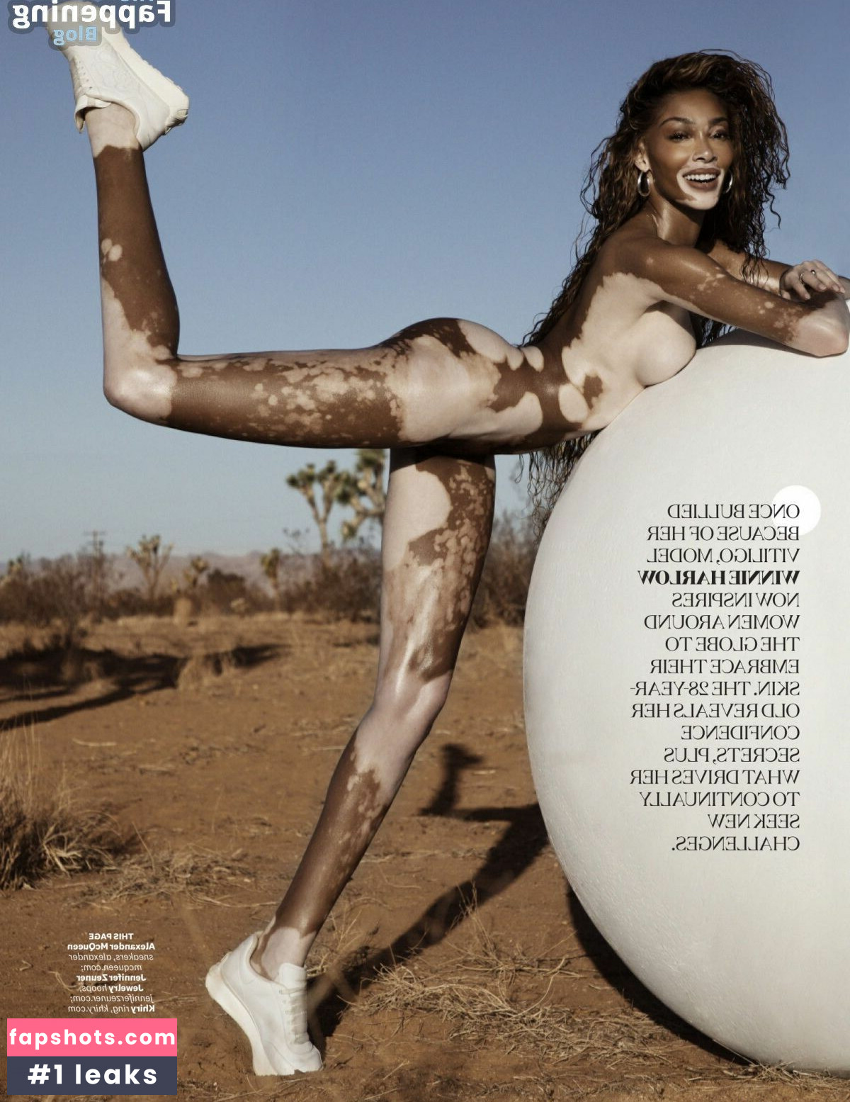 Winnie Harlow Nude Leaks OnlyFans Photos #236 - LeakJerk
