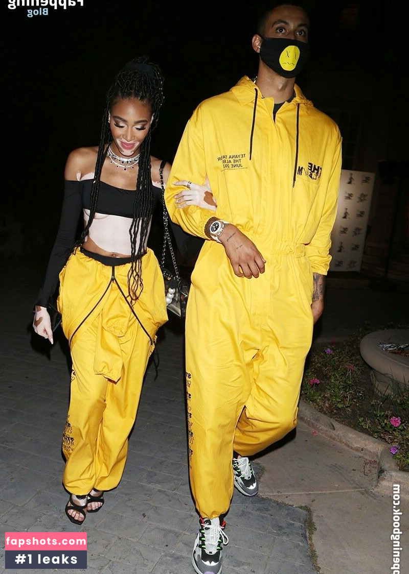 Winnie Harlow Nahé úniky fotek pouze od fanoušků #266 - Fapshots