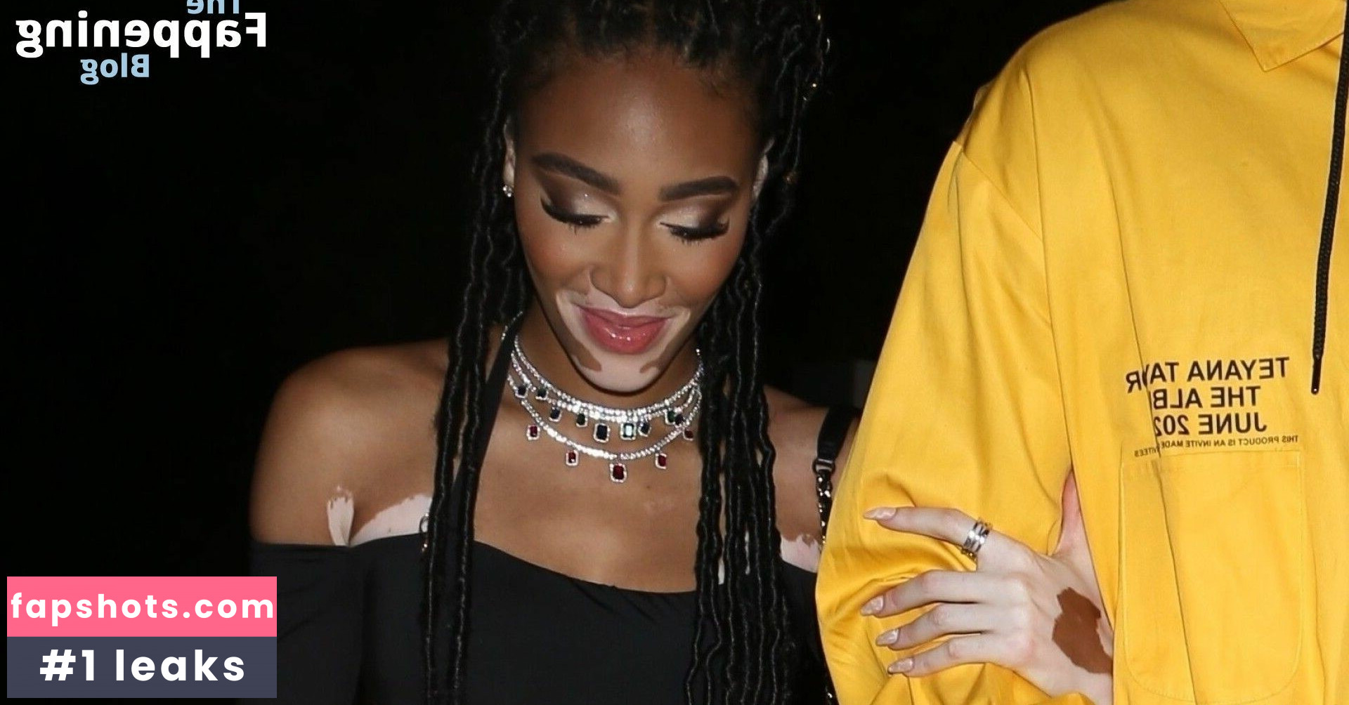 Winnie Harlow Nahé úniky fotek pouze od fanoušků #267 - Fapshots