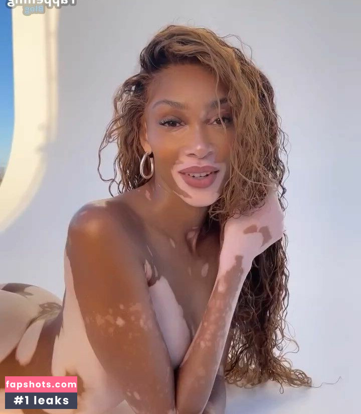 Winnie Harlow Nahé úniky fotek pouze od fanoušků #274 - Fapshots