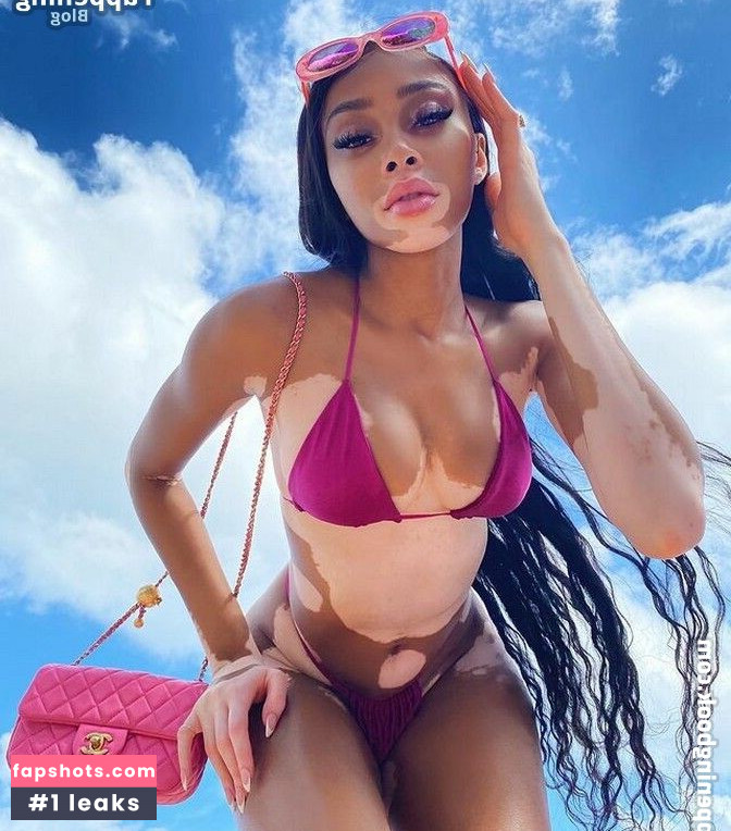 Winnie Harlow Nahé úniky fotek pouze od fanoušků #280 - Fapshots