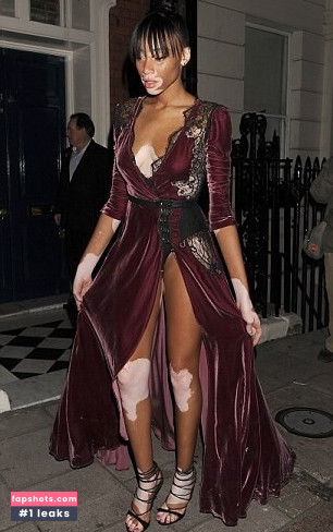 Winnie Harlow Nude Leaks OnlyFans Photos #29 - LeakJerk