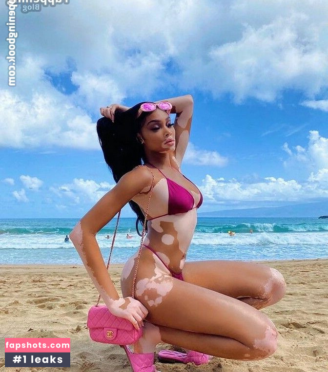 Winnie Harlow Nahé úniky fotek pouze od fanoušků #281 - Fapshots