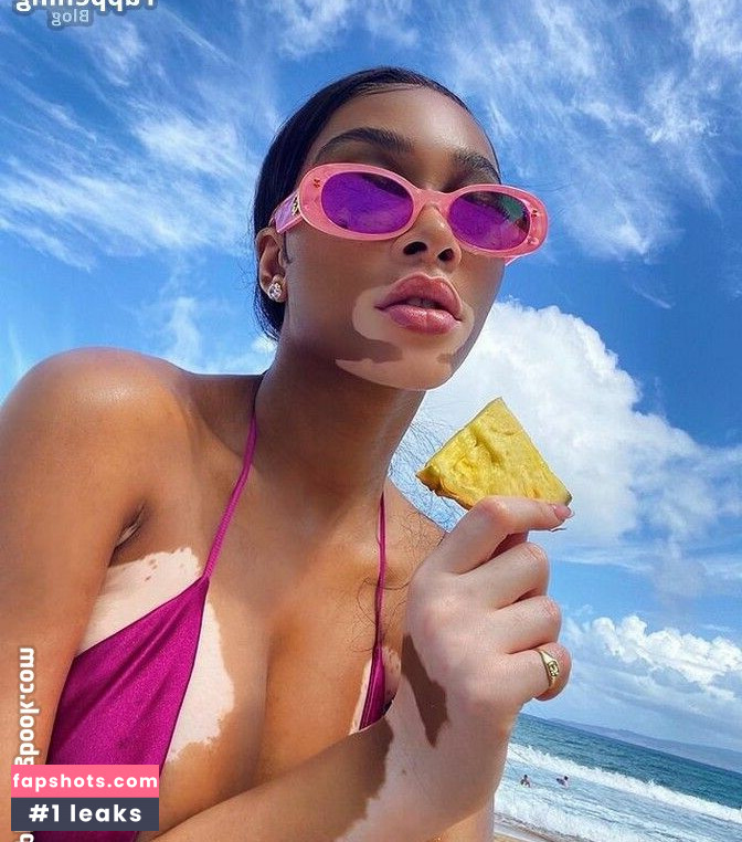 Winnie Harlow Nahé úniky fotek pouze od fanoušků #282 - Fapshots