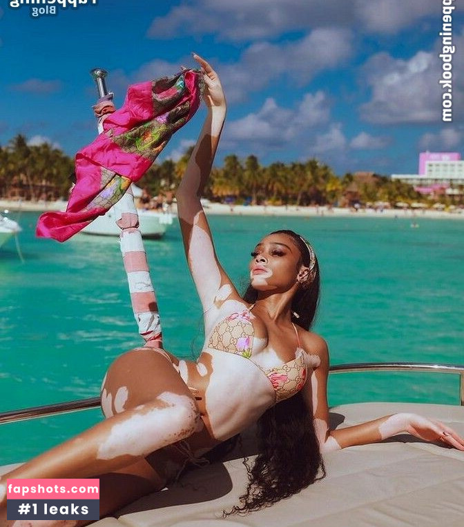 Winnie Harlow Nahé úniky fotek pouze od fanoušků #283 - Fapshots