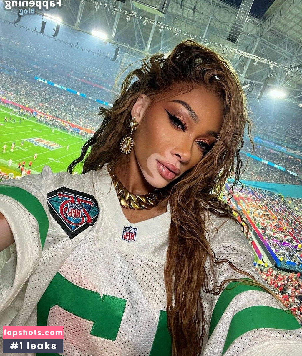Winnie Harlow Nahé úniky fotek pouze od fanoušků #285 - Fapshots