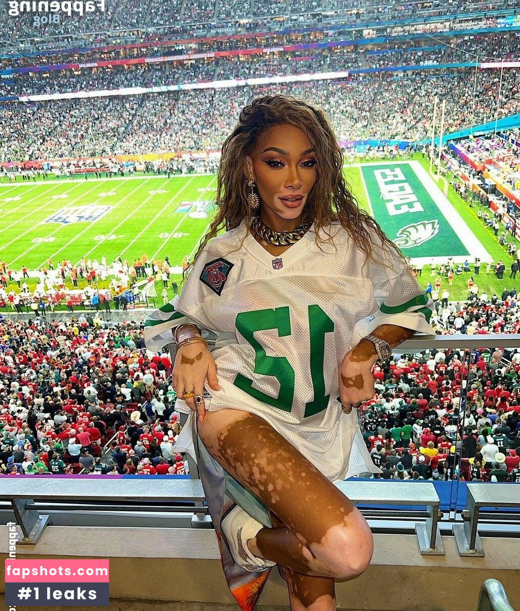 Winnie Harlow Nahé úniky fotek pouze od fanoušků #286 - Fapshots