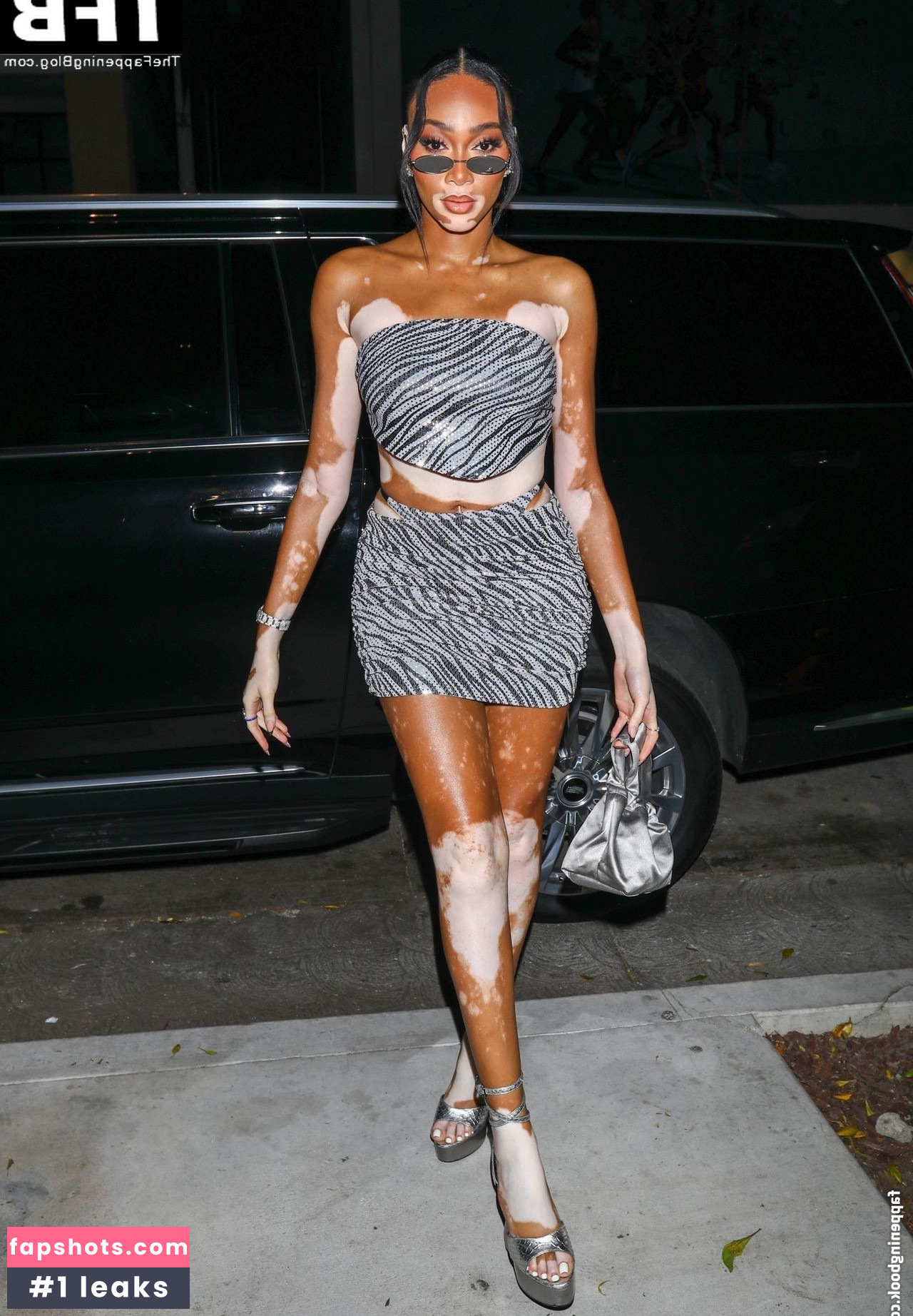 Winnie Harlow Nude Leaks OnlyFans Photos #381 - LeakJerk