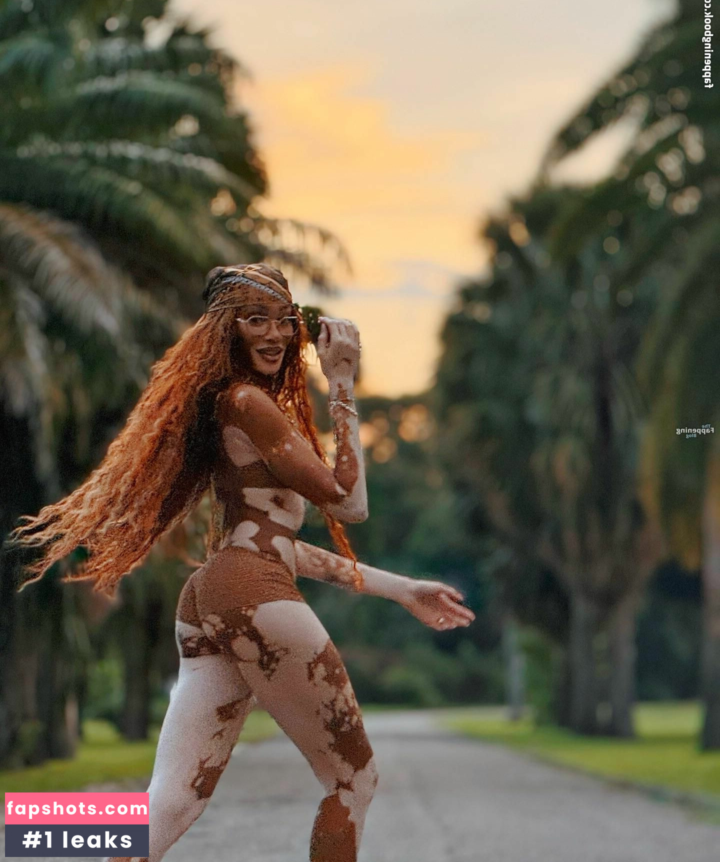 Winnie Harlow Nacktheit OnlyFans Fotos #47 - Fapshots