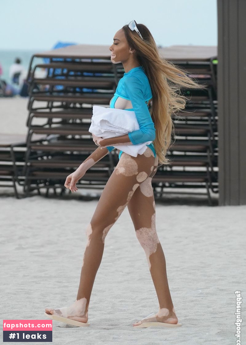 Winnie Harlow Nacktheit OnlyFans Fotos #475 - Fapshots