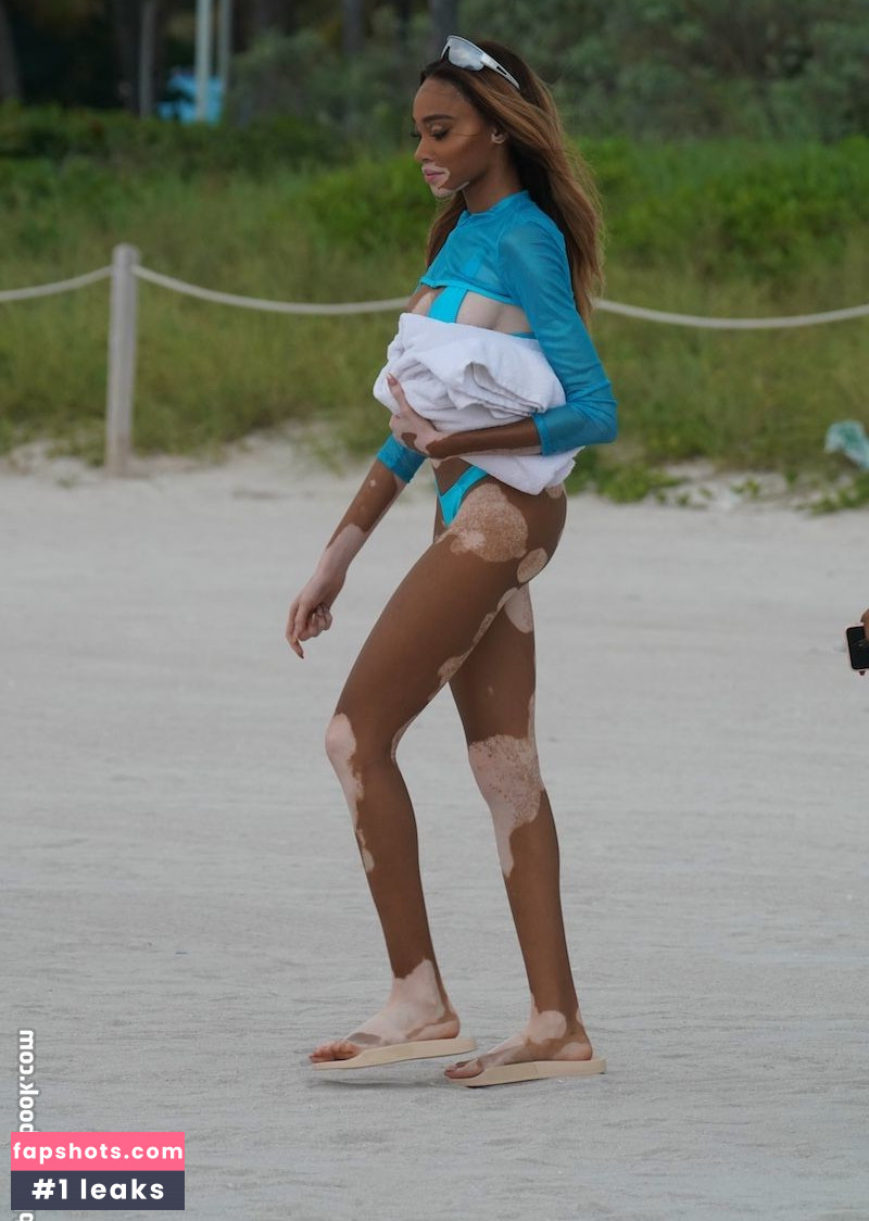 Winnie Harlow Nacktheit OnlyFans Fotos #477 - Fapshots