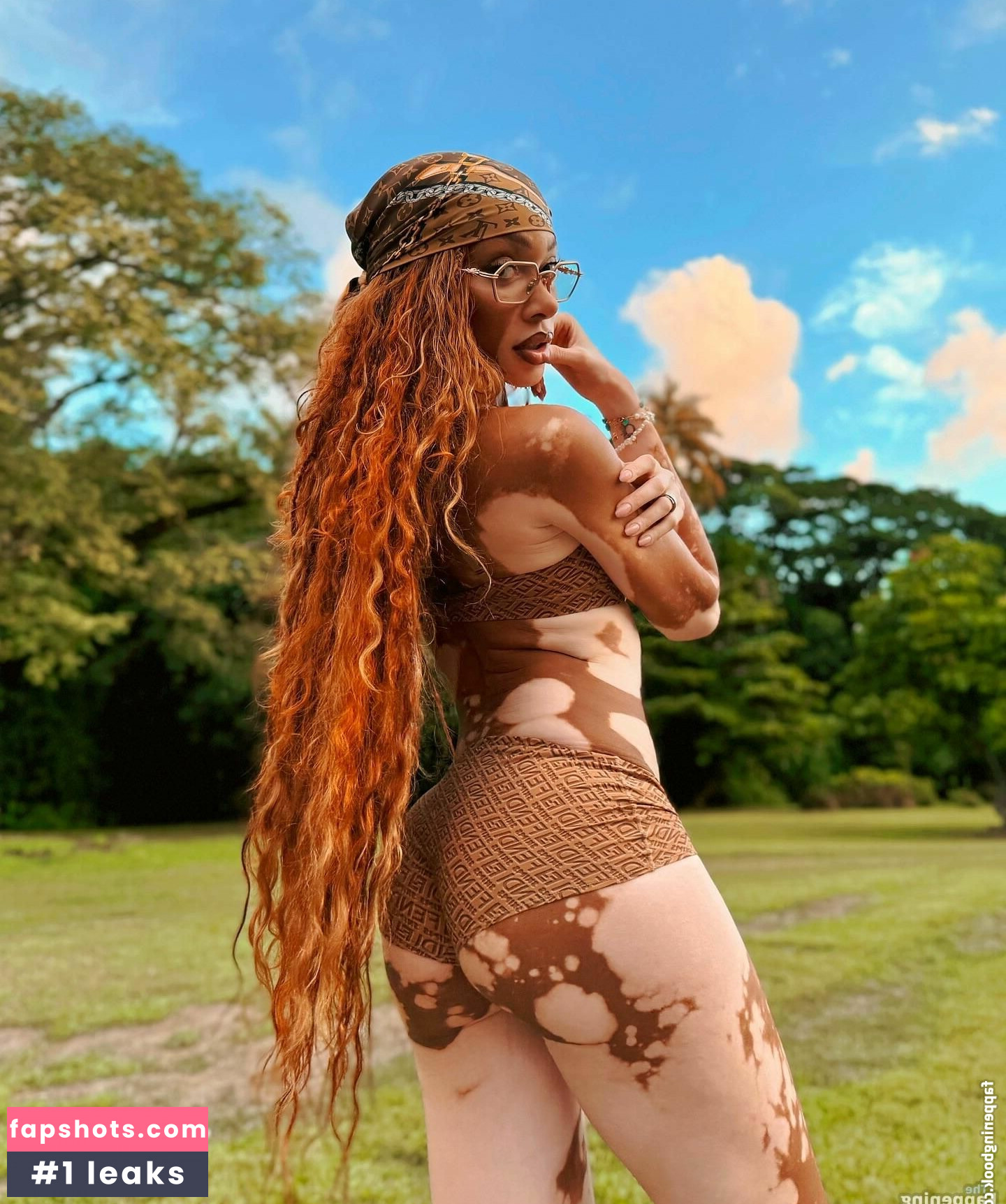 Winnie Harlow Nude Leaks OnlyFans Photos #50 - LeakJerk