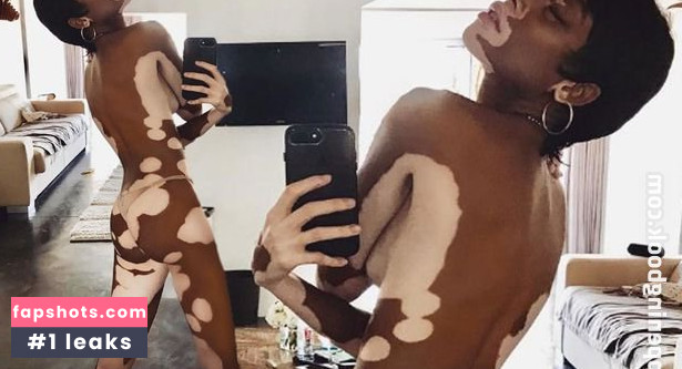 Winnie Harlow Nacktheit OnlyFans Fotos #516 - Fapshots